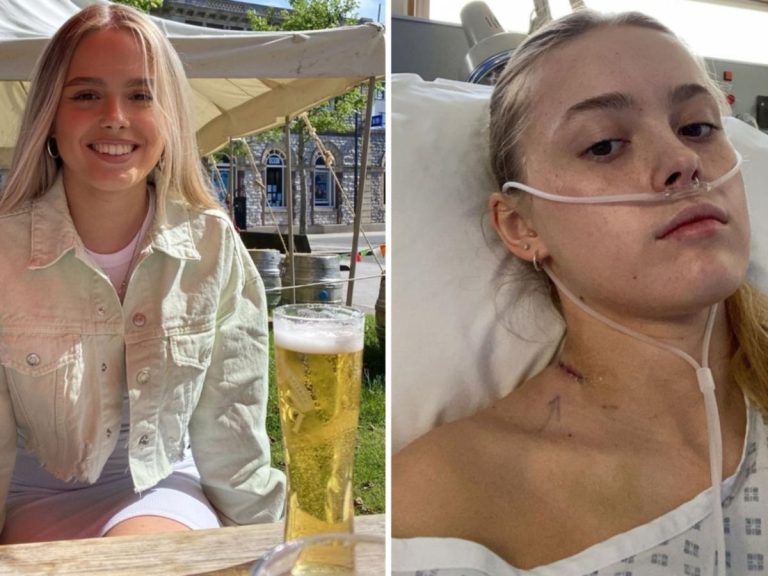 Student’s heartburn from partying too much led to her fighting for life