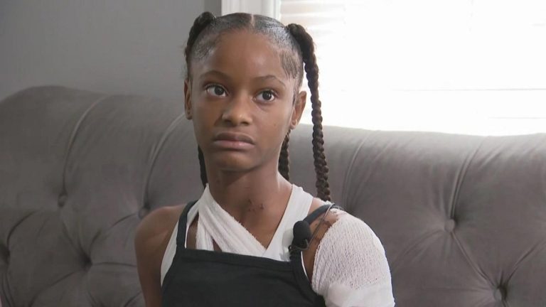 12-Year-Old Charged in Acid Attack on Detroit Playground