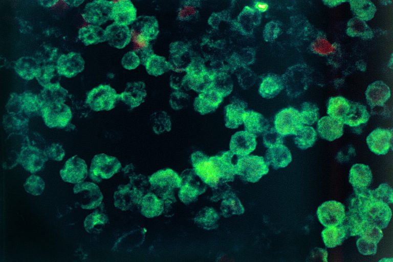 Brain-Eating Amoeba Kills Georgia Resident