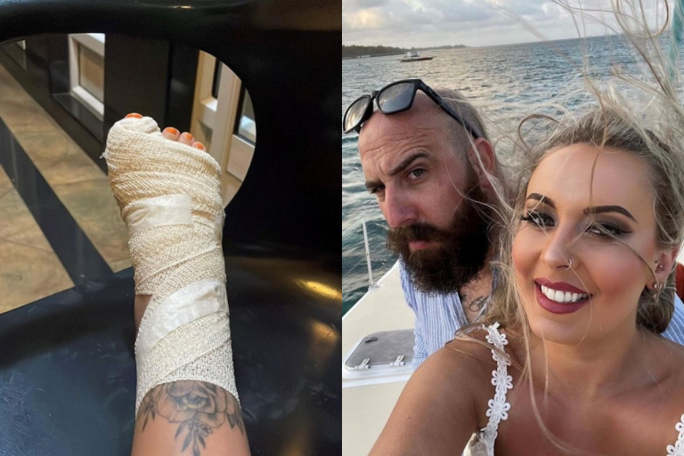 Bride stung by world’s most venomous fish while on honeymoon