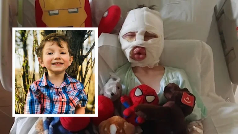6-Year-Old Boy Hospitalized After Bully Blasts Him With Burning Ball