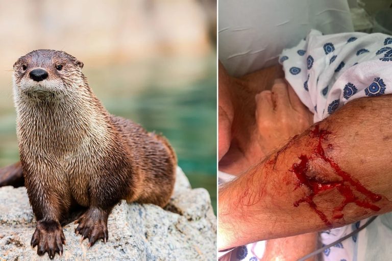 Terrifying Otter Attack in Northern California Leaves Swimmer Injured