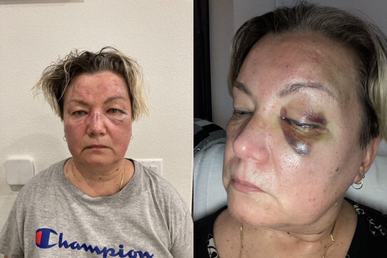 Las Vegas Uber driver viciously attacked by her passengers