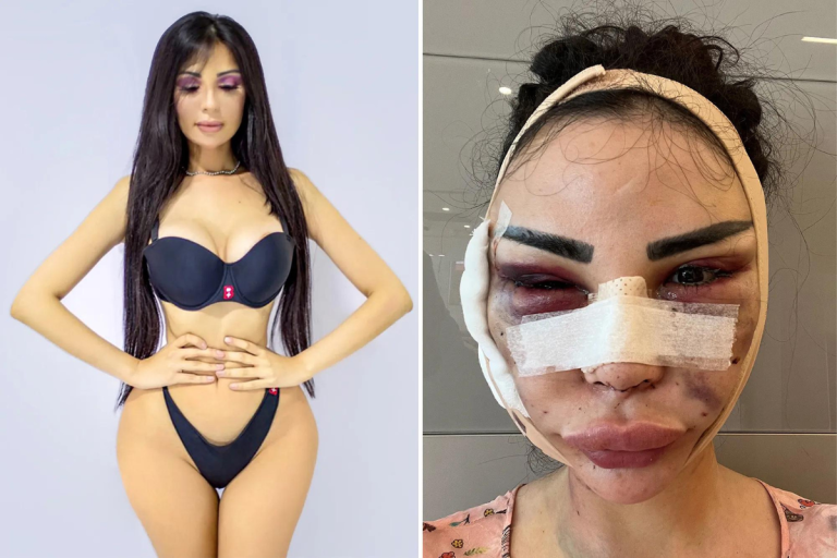 Versace model spent $600,000 to look like Kim K. now paying $120,000 to detransition