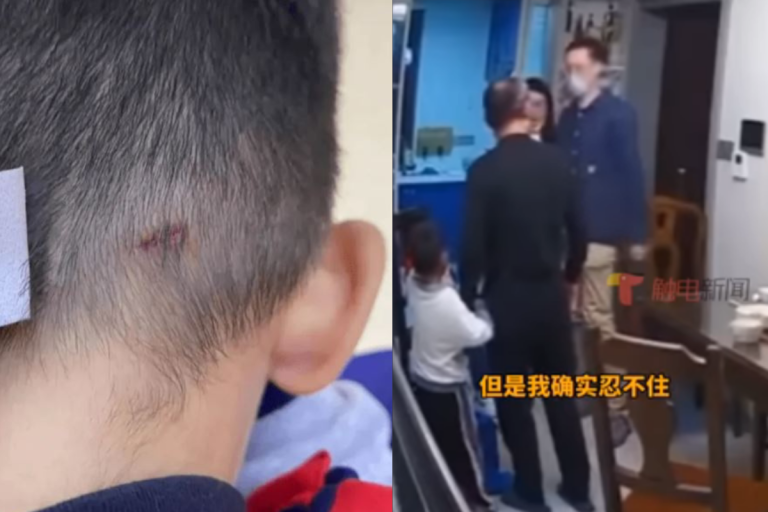 33-year-old man in China slapped a kid, faces assault charges