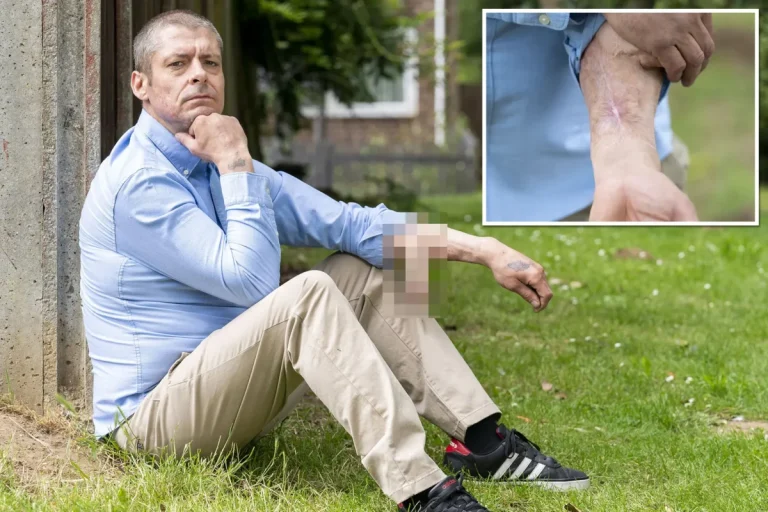 Infection causes man’s penis to fall off and regrow on his arm