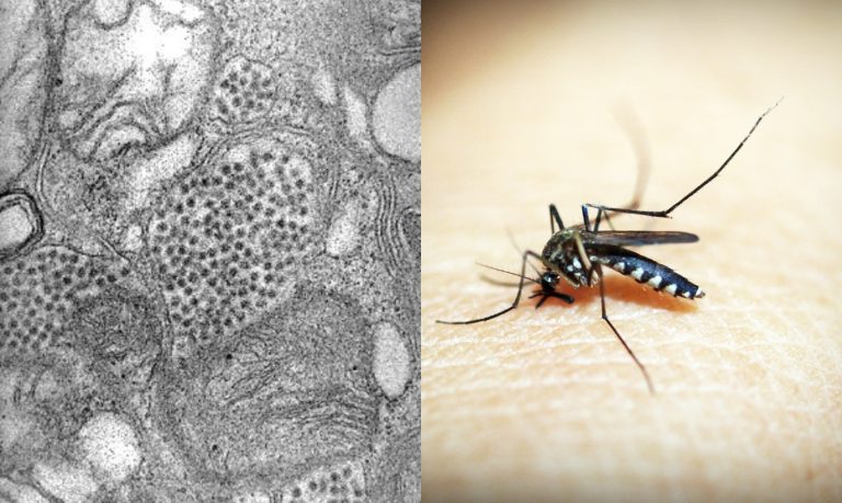 Eastern Equine Encephalitis