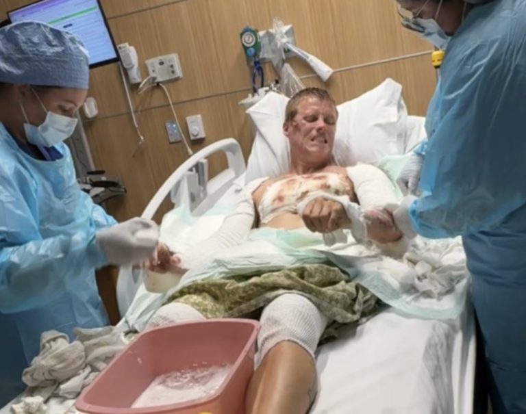 Man Suffers Burns After Phoenix Police Detain Him on Hot Pavement